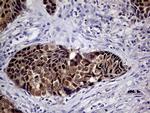 CDKN2A Antibody in Immunohistochemistry (Paraffin) (IHC (P))