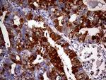 CDKN2A Antibody in Immunohistochemistry (Paraffin) (IHC (P))