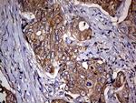 CDKN2A Antibody in Immunohistochemistry (Paraffin) (IHC (P))