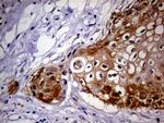 CDKN2A Antibody in Immunohistochemistry (Paraffin) (IHC (P))