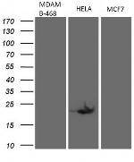 CDKN2A Antibody in Western Blot (WB)