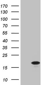 CDKN2A Antibody in Western Blot (WB)