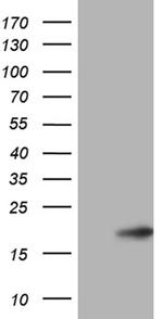 CDKN2A Antibody in Western Blot (WB)