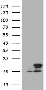 CDKN2A Antibody in Western Blot (WB)