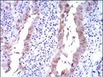 p16INK4a Antibody in Immunohistochemistry (Paraffin) (IHC (P))