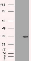 CDX2 Antibody in Western Blot (WB)