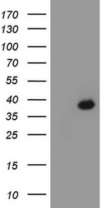 CDX2 Antibody in Western Blot (WB)