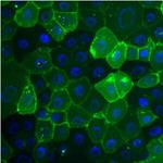 CEA Antibody in Immunocytochemistry (ICC/IF)