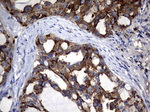 CEA (CEACAM5) Antibody in Immunohistochemistry (Paraffin) (IHC (P))