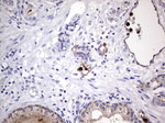 CEA (CEACAM5) Antibody in Immunohistochemistry (Paraffin) (IHC (P))