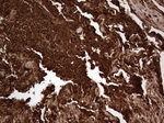 CEA (CEACAM5) Antibody in Immunohistochemistry (Paraffin) (IHC (P))