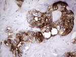 CEA (CEACAM5) Antibody in Immunohistochemistry (Paraffin) (IHC (P))