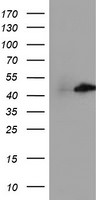 CENPH Antibody in Western Blot (WB)