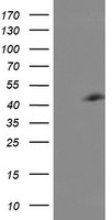 CENPH Antibody in Western Blot (WB)