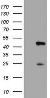 CENPH Antibody in Western Blot (WB)