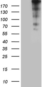 CENPJ Antibody in Western Blot (WB)