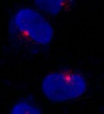 CEP290 Antibody in Immunocytochemistry (ICC/IF)