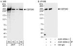 CEP290 Antibody in Western Blot (WB)