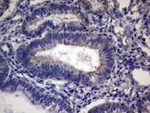 CEP63 Antibody in Immunohistochemistry (Paraffin) (IHC (P))