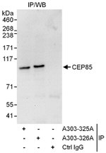 CEP85 Antibody in Immunoprecipitation (IP)