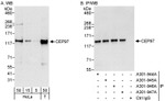 CEP97 Antibody in Western Blot (WB)