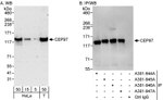 CEP97 Antibody in Western Blot (WB)