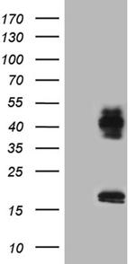 CERS2 Antibody in Western Blot (WB)