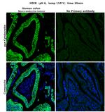 pan Cytokeratin (pan CK) Antibody in Immunohistochemistry (Paraffin) (IHC (P))