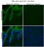 pan Cytokeratin (pan CK) Antibody