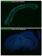 pan Cytokeratin (pan CK) Antibody