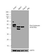 pan Cytokeratin (pan CK) Antibody in Western Blot (WB)