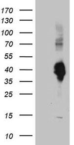 CLEC10A Antibody in Western Blot (WB)