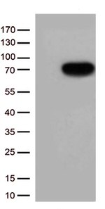 GM CSF Receptor alpha (CSF2RA) Antibody in Western Blot (WB)