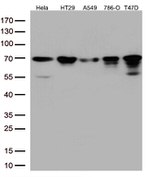 MSF (SEPT9) Antibody in Western Blot (WB)