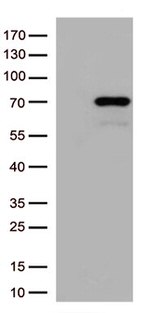 MSF (SEPT9) Antibody in Western Blot (WB)