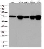 MSF (SEPT9) Antibody in Western Blot (WB)