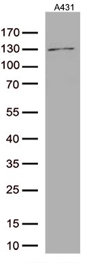 ARTS1 (ERAP1) Antibody in Western Blot (WB)