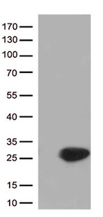 Cytoglobin (CYGB) Antibody in Western Blot (WB)