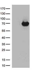 ARSB Antibody in Western Blot (WB)