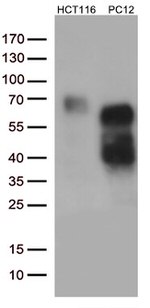 p75 NGF Receptor (NGFR) Antibody in Western Blot (WB)