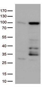 EWSR1 Antibody in Western Blot (WB)