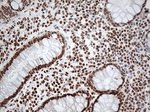 EWSR1 Antibody in Immunohistochemistry (Paraffin) (IHC (P))