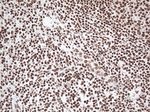 EWSR1 Antibody in Immunohistochemistry (Paraffin) (IHC (P))