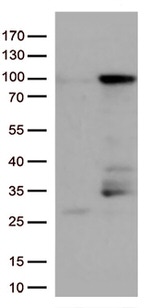 EWSR1 Antibody in Western Blot (WB)