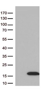 Diazepam Binding Inhibitor (DBI) Antibody in Western Blot (WB)