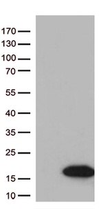 Diazepam Binding Inhibitor (DBI) Antibody in Western Blot (WB)