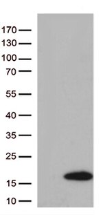 Diazepam Binding Inhibitor (DBI) Antibody in Western Blot (WB)