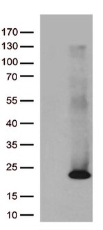 ASF1B Antibody in Western Blot (WB)