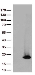 ASF1B Antibody in Western Blot (WB)