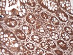 PKR (EIF2AK2) Antibody in Immunohistochemistry (Paraffin) (IHC (P))